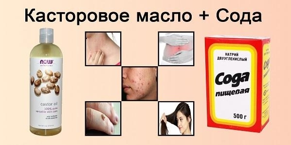 КАСТОРОВОЕ МАСЛО И ПИЩЕВАЯ СОДА Представляем вашему вниманию чудодействующую смесь, которая способна избавить от целого ряда заболеваний, просто укрепить и омолодить организм. На такое способно